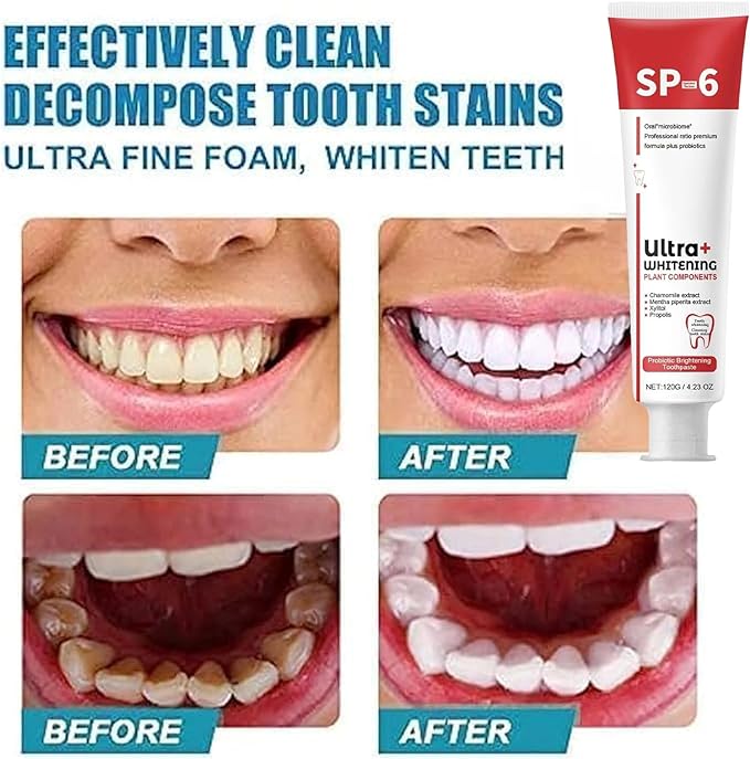 Super Probiotic-6 Toothpaste with 6 Probiotics oalance Oral microbiota strength