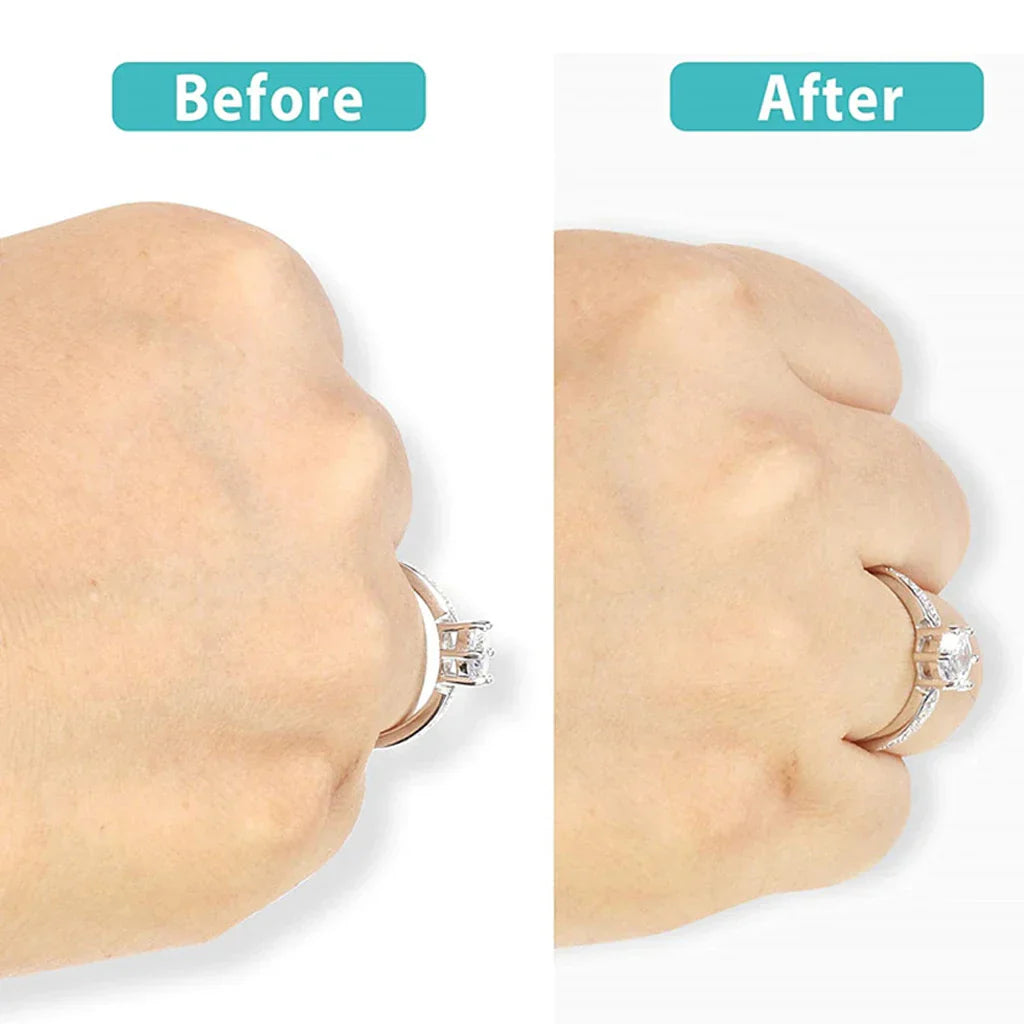 Ring Re-sizer Set