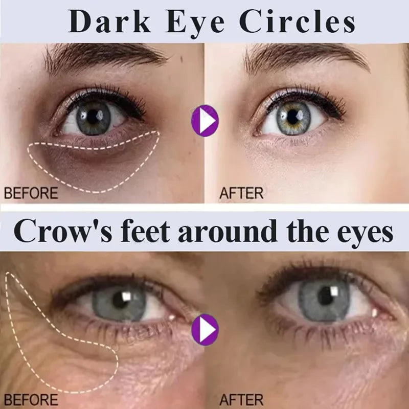 Fix Under-Eye Cream, Brighten Under Eyes
