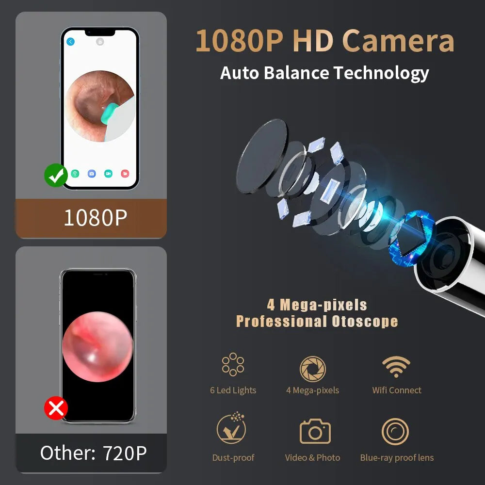 Smart Visual Ear Spoon Tool Set