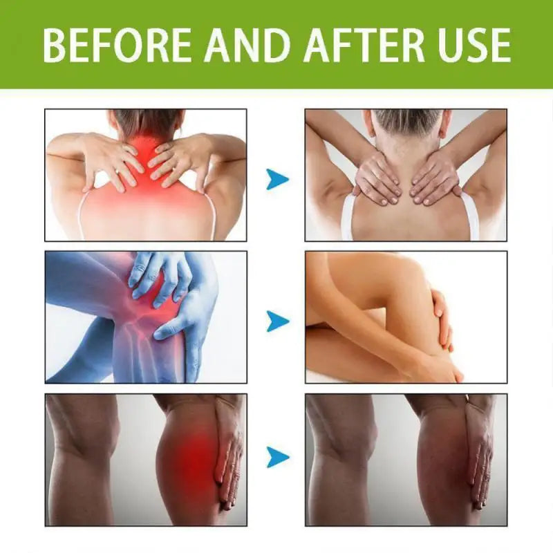Hempvana Arthritis Pain Relief Gel