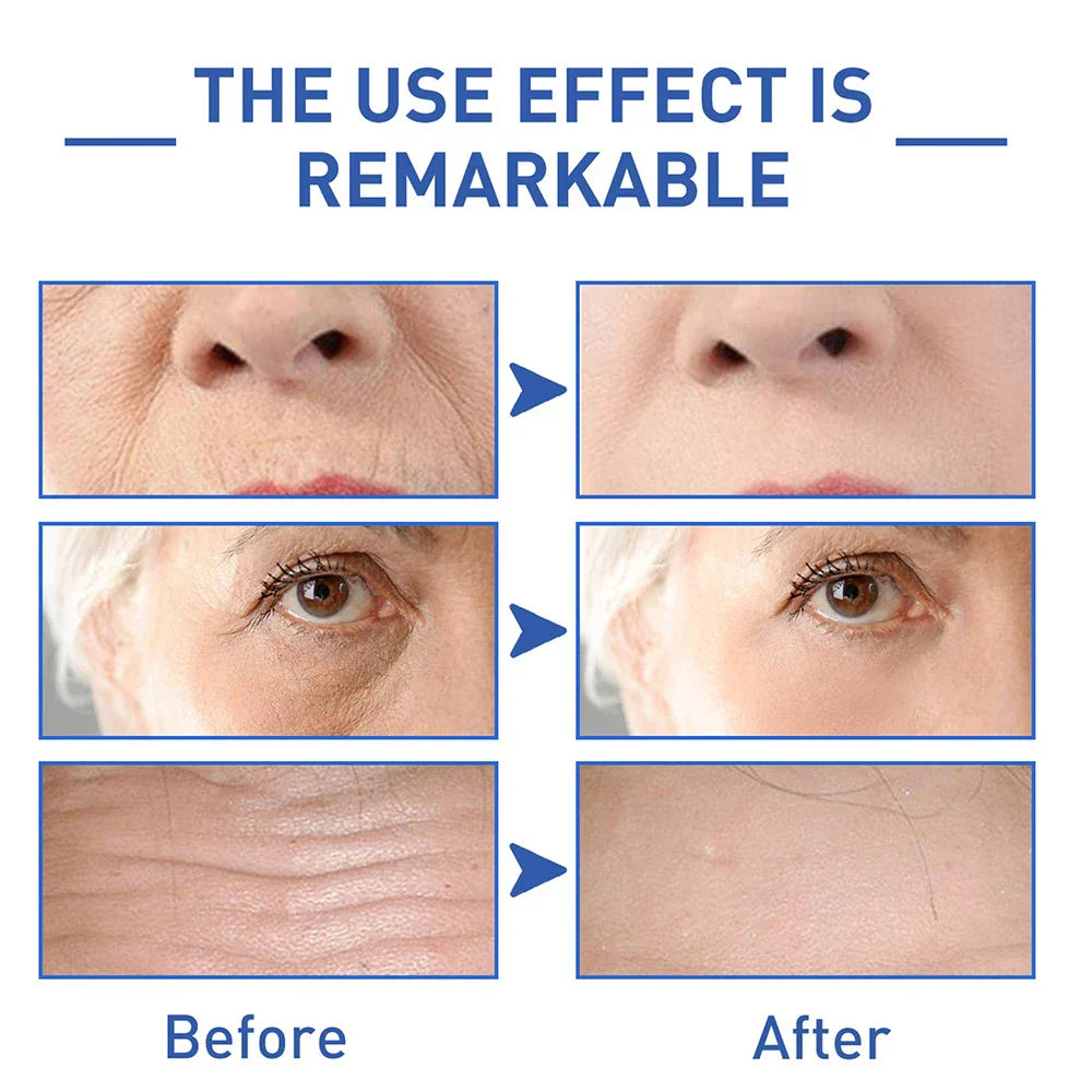 Botox Face Serum