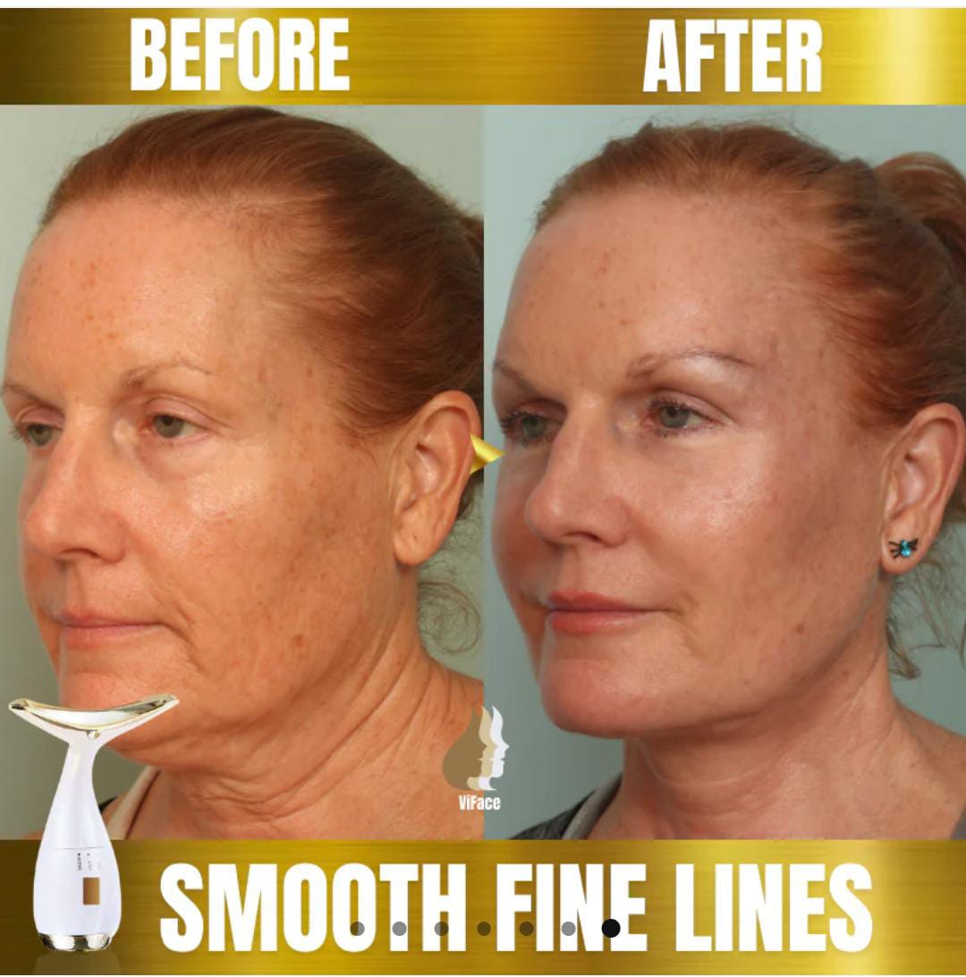 ViFace ultrasonic facial lifting massager