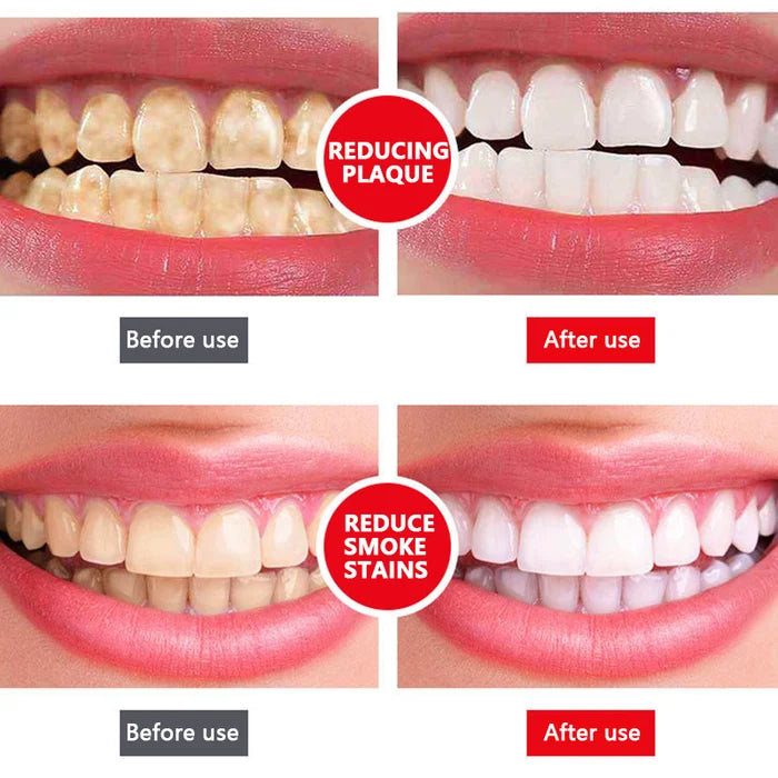Super Probiotic-6 Toothpaste with 6 Probiotics oalance Oral microbiota strength