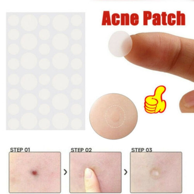 Moles & Warts Removing Skin Tag Patch