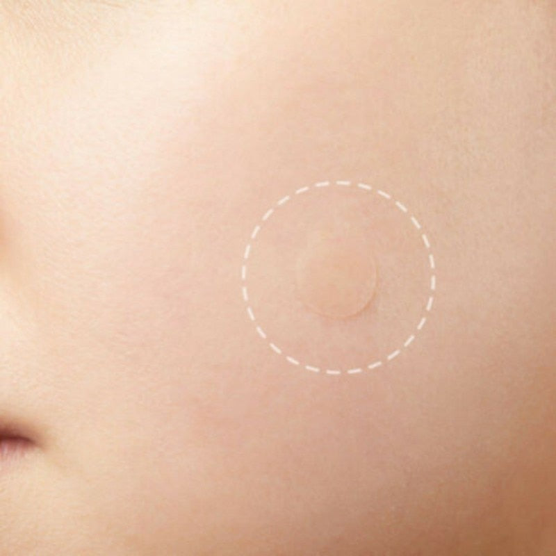 Moles & Warts Removing Skin Tag Patch