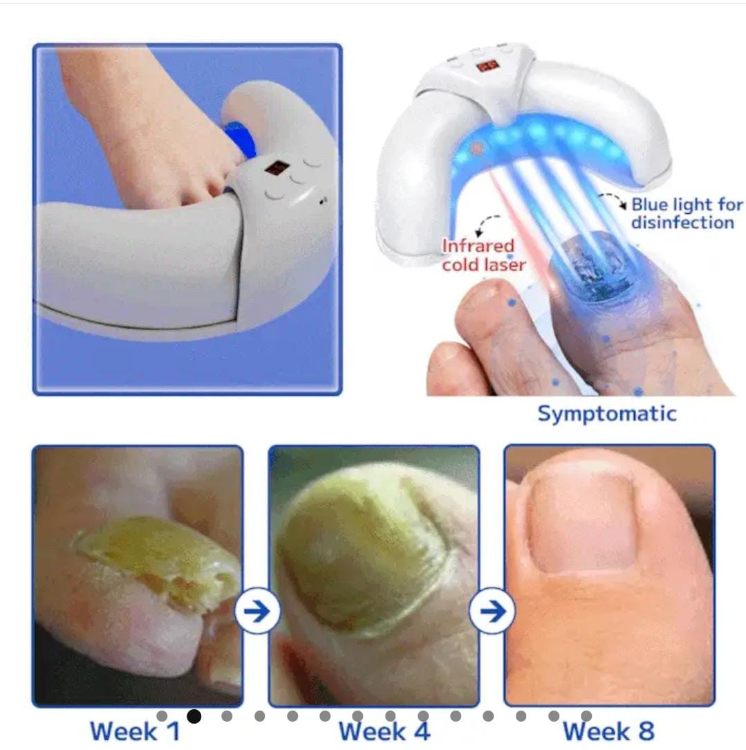 Fungal nail treatment laser device
