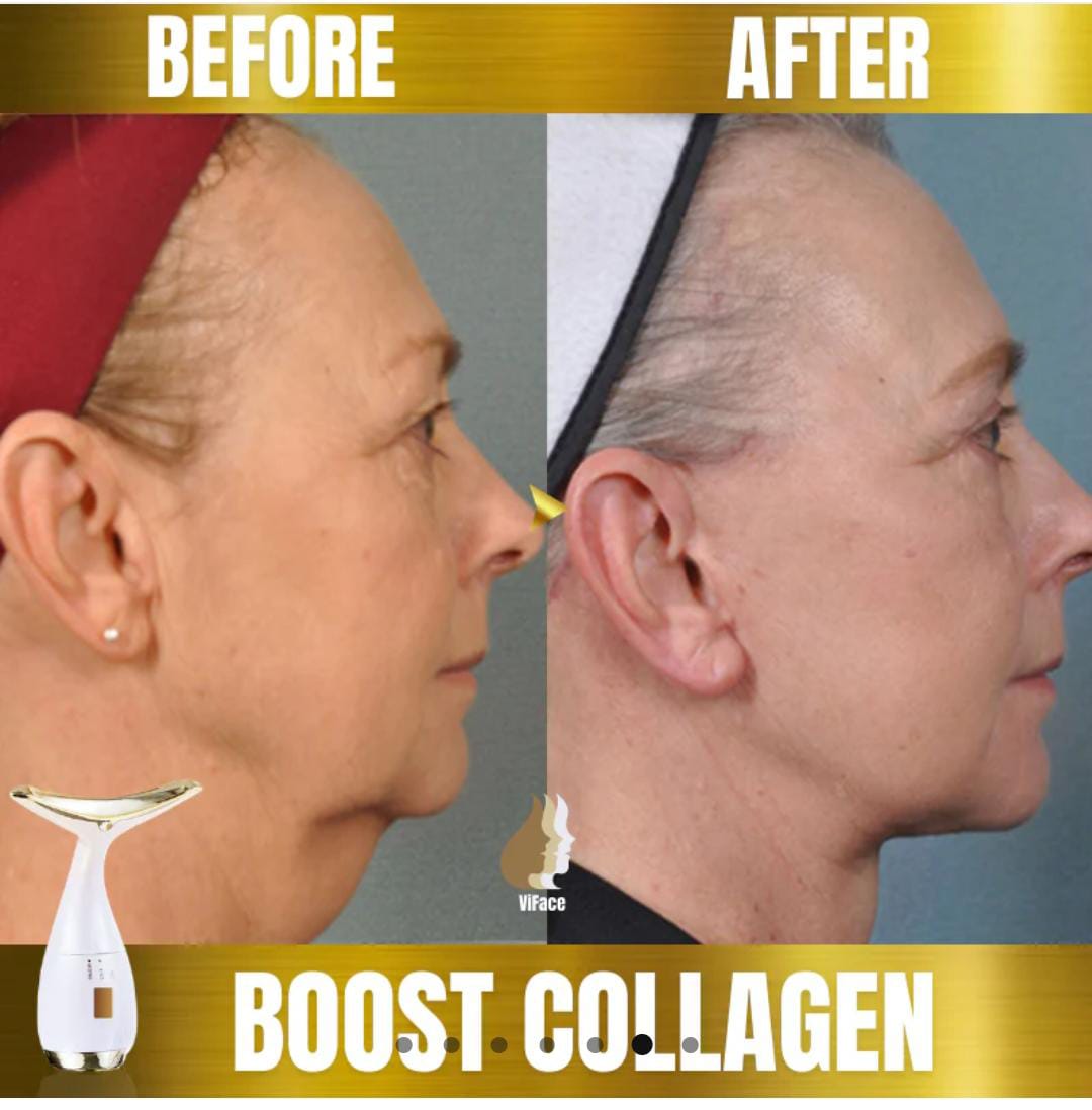 ViFace ultrasonic facial lifting massager