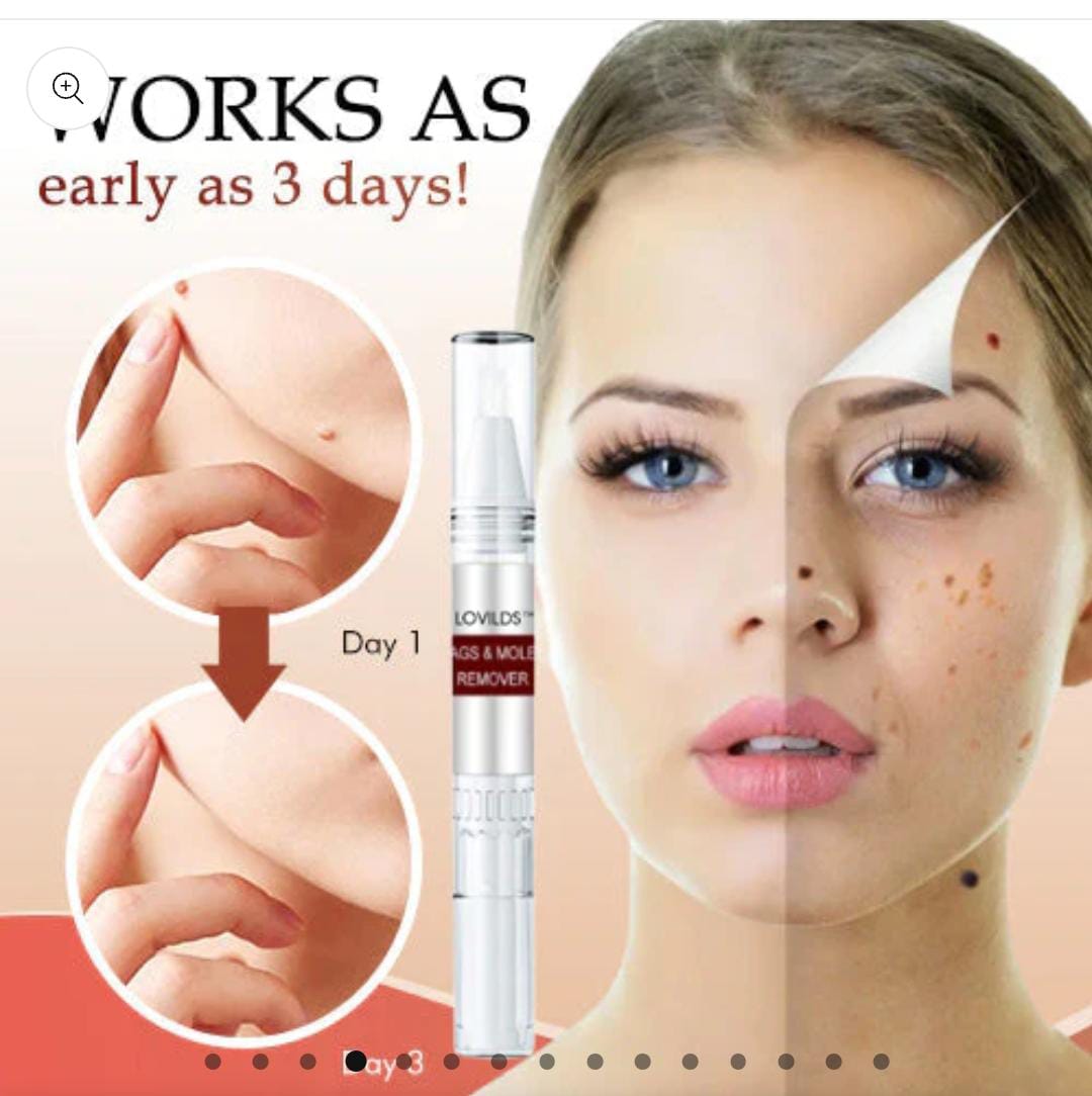 TAGS & MOLES REMOVER