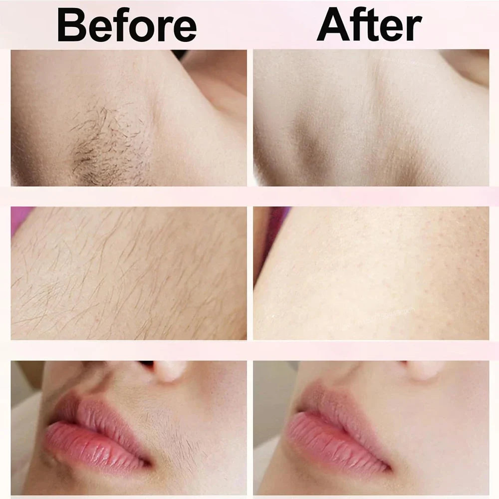 Portable Painless Epilator