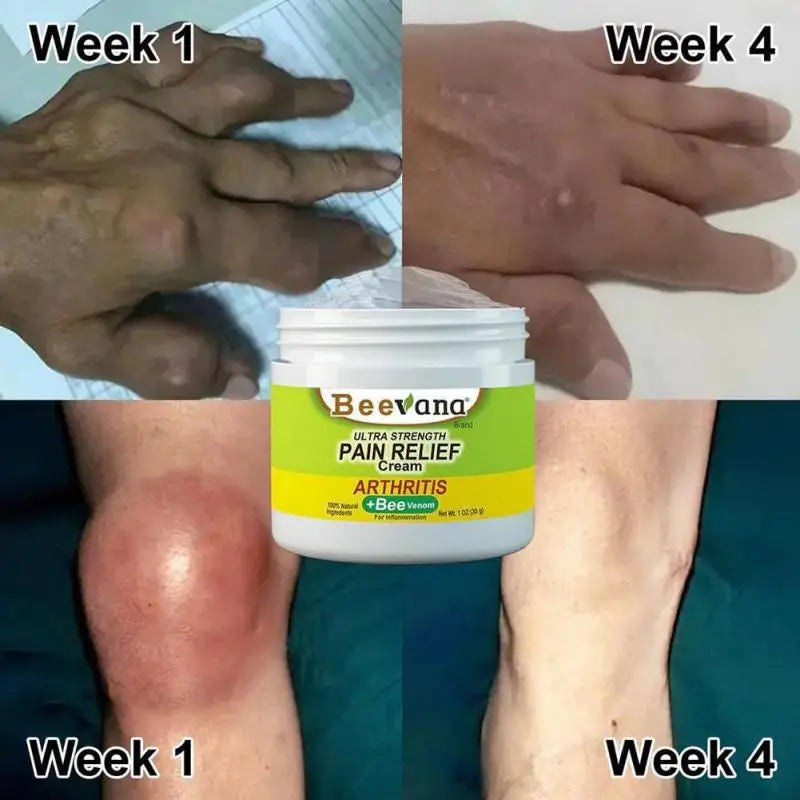 Hempvana Arthritis Pain Relief Gel
