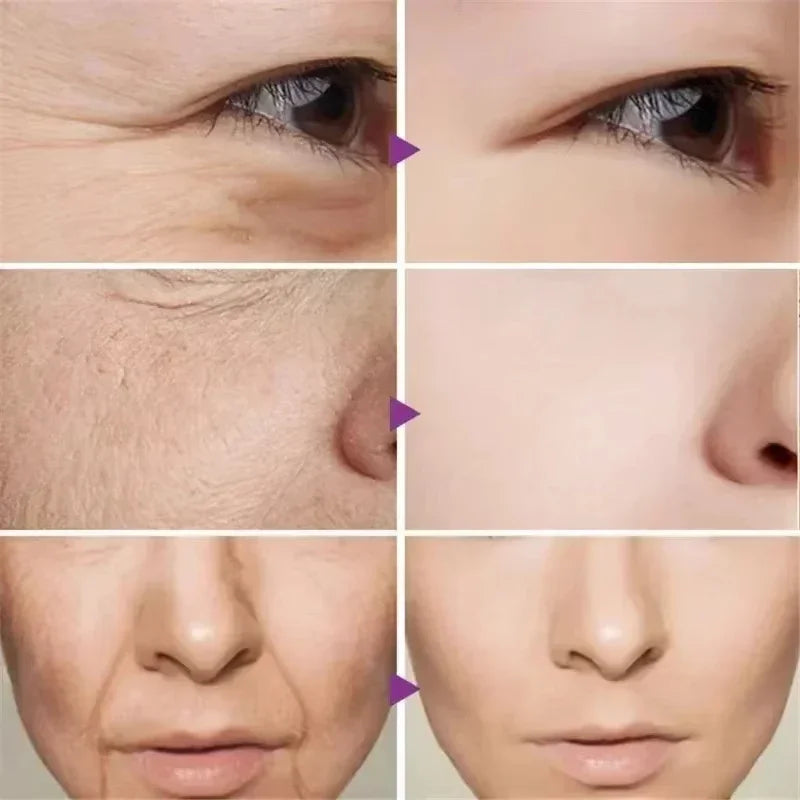 Fix Under-Eye Cream, Brighten Under Eyes