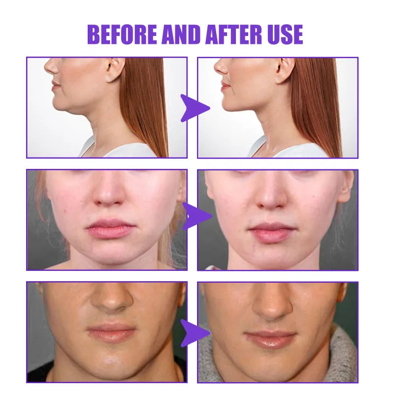 V-Shape Face-lift Slimming Cream