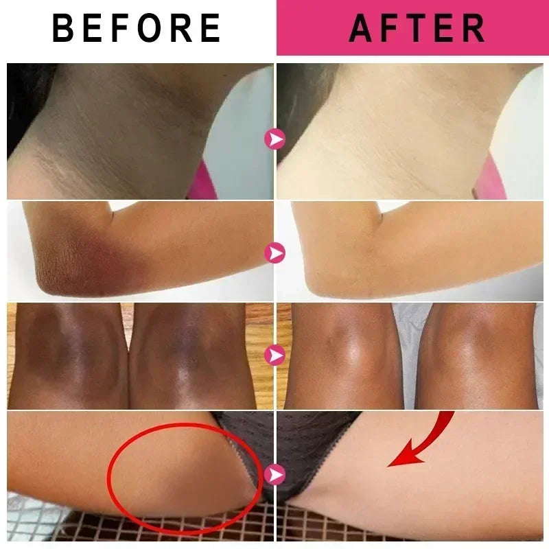 Vitamin C Underarm Whitening Cream For Women Body Brightening Emulsion