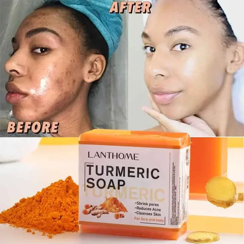 Turmeric Brightening Soap