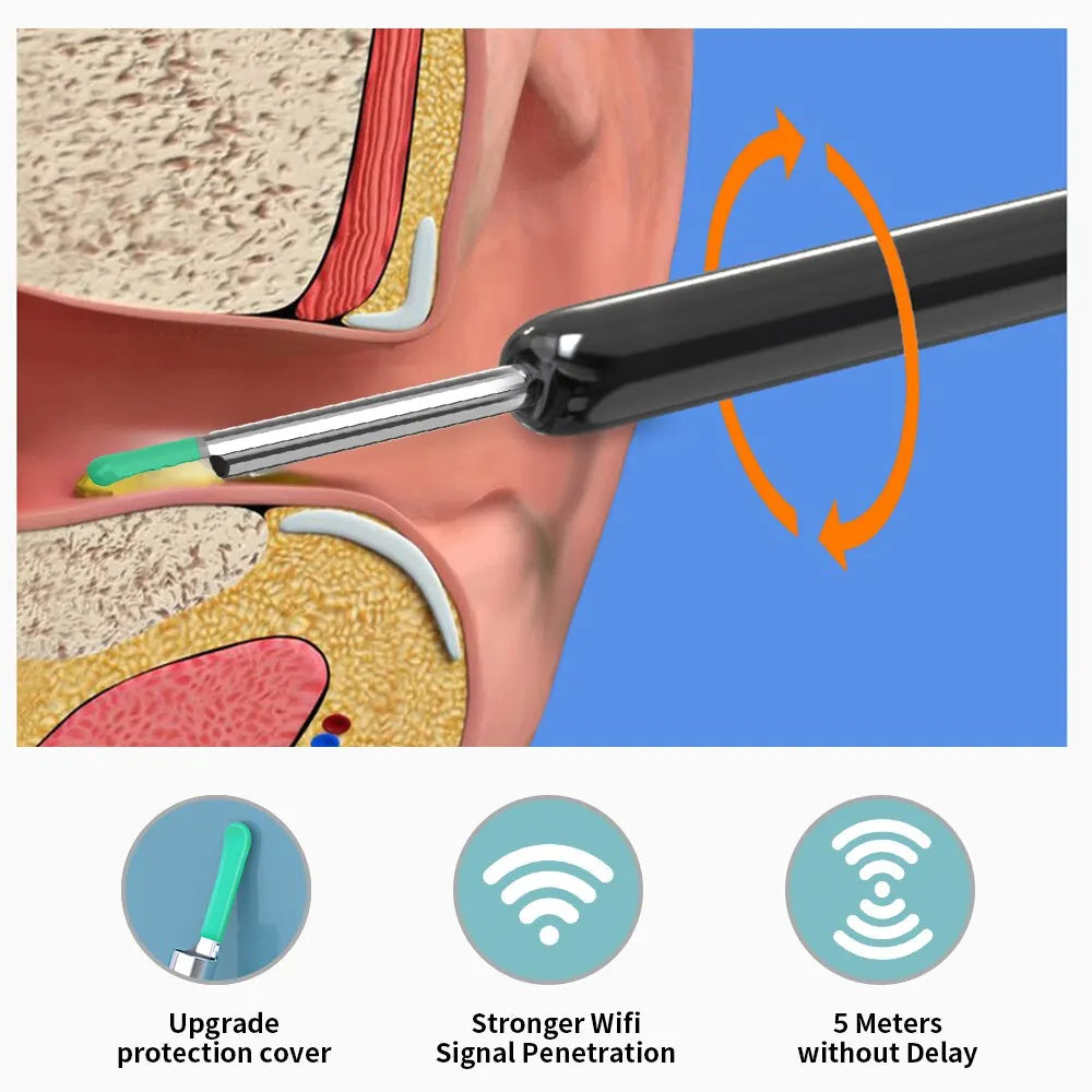 Smart Visual Ear Spoon Tool Set