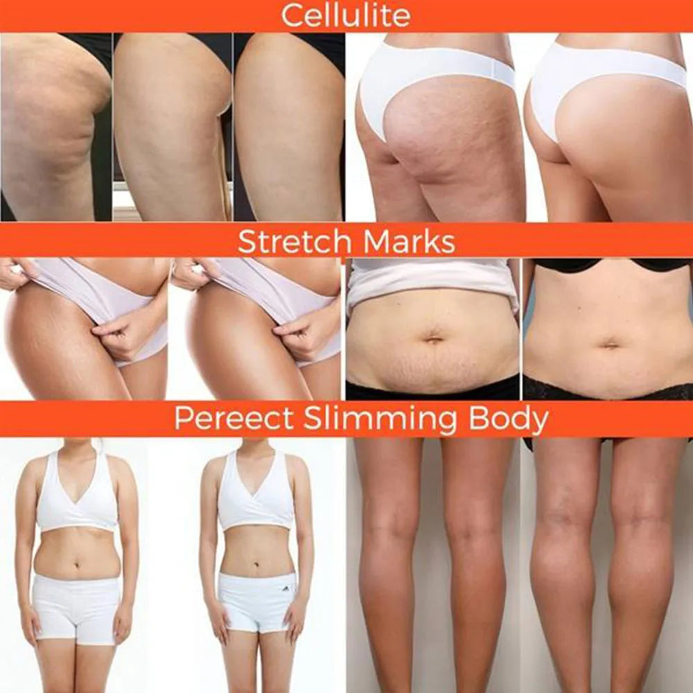 Ginger Fat Burning Cream