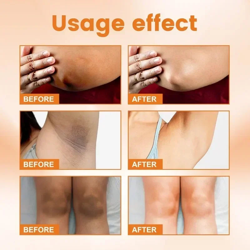 Vitamin C Underarm Whitening Cream For Women Body Brightening Emulsion