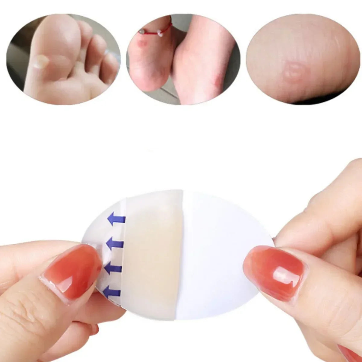 Hydrocolloid Gel Heel Patch