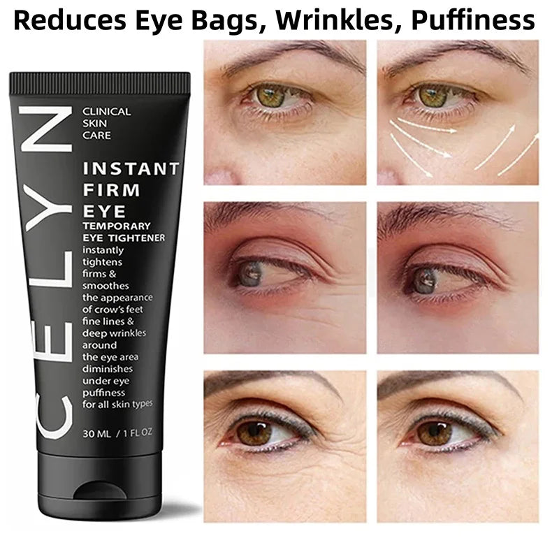 FIRM Eye Tightener