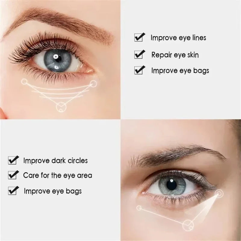 Fix Under-Eye Cream, Brighten Under Eyes