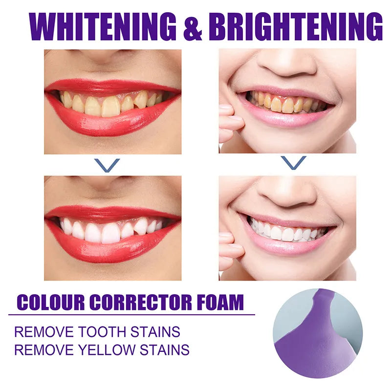 Teeth Colour Corrector Serum
