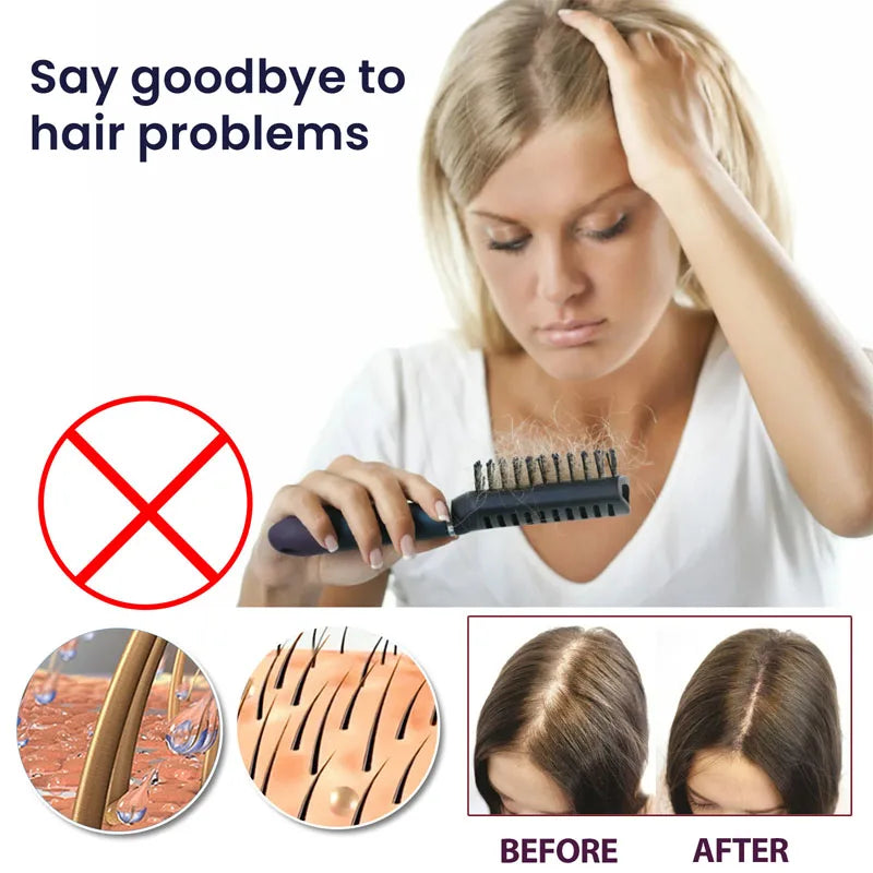 Natural Hair Regrowth Spray