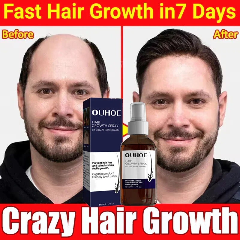 Natural Hair Regrowth Spray