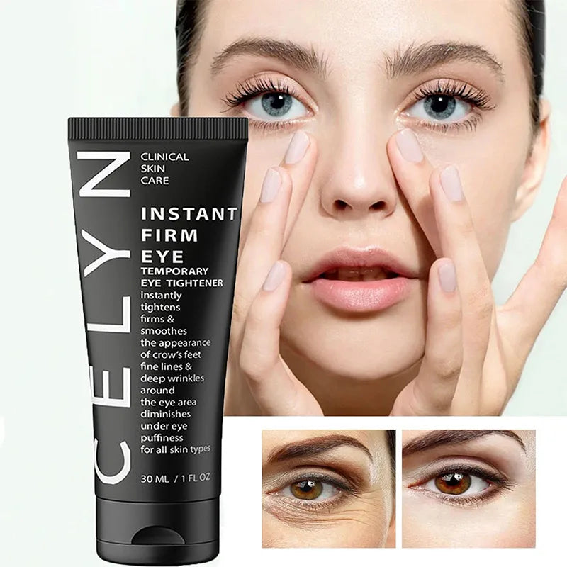 FIRM Eye Tightener