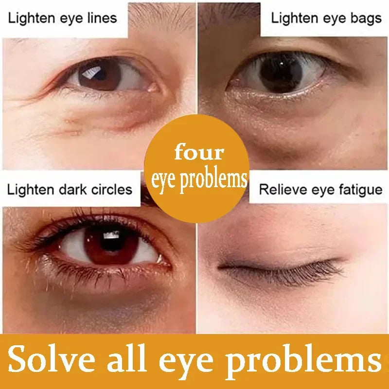 Dinkiss Lutein Eye Essence Oil
