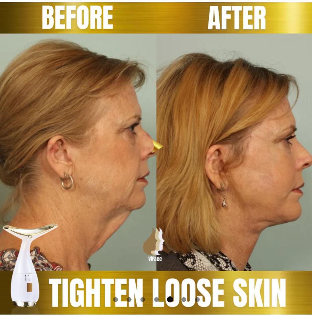 ViFace ultrasonic facial lifting massager
