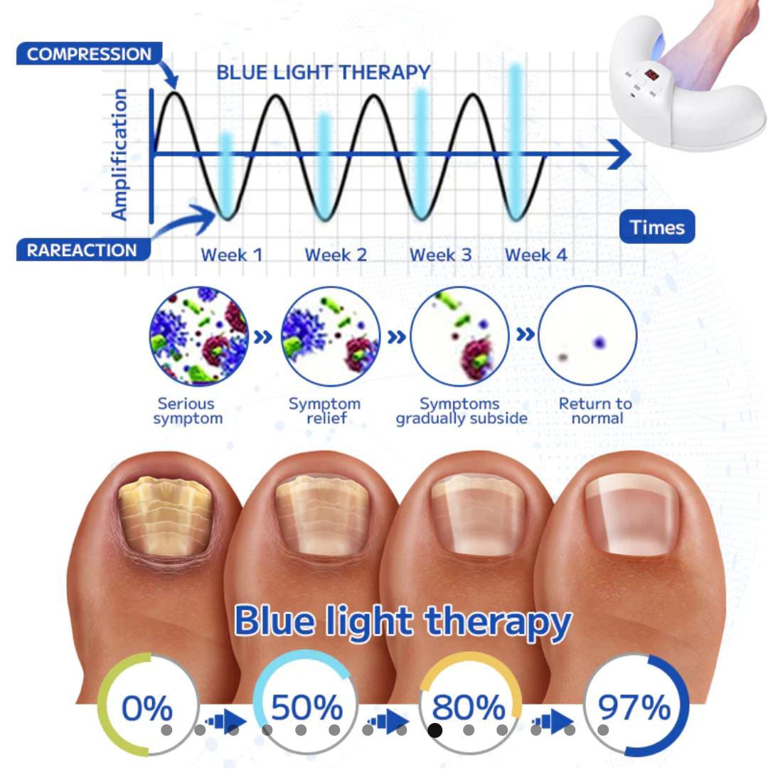 Fungal nail treatment laser device