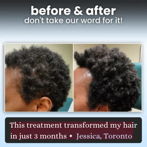 Raw Batana Natural Hair Grow Oil